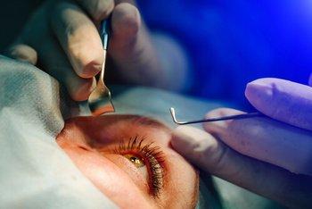 A close-up of a person's eye during LASIK eye surgery, with gloved hands holding surgical tools near the eyelid, and a blue light shining in the background for vision correction.